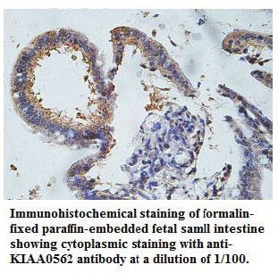Anti-KIAA0562 Antibody