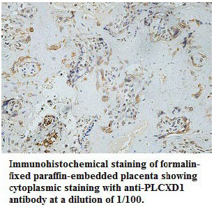 Anti-PLCXD1 Antibody