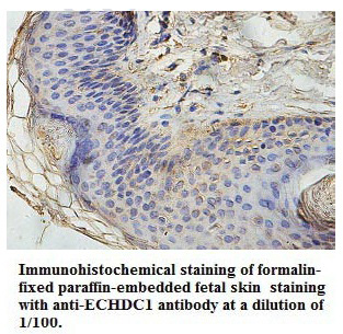 Anti-ECHDC1 Antibody