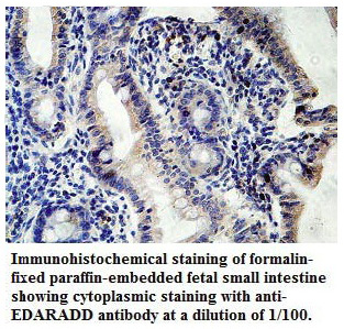Anti-EDARADD Antibody