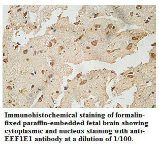 Anti-EEF1E1 Antibody