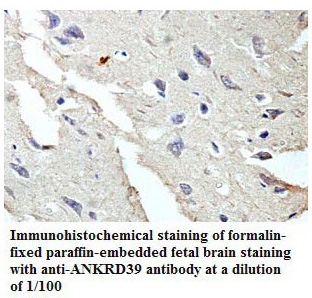 Anti-ANKRD39 Antibody