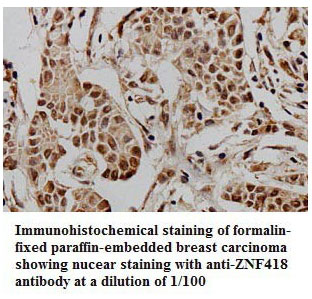Anti-ZNF418 Antibody