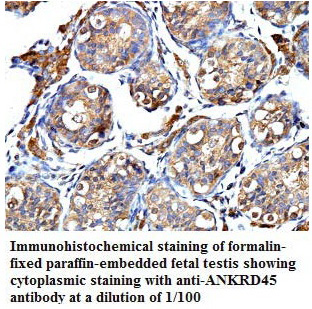 Anti-ANKRD45 Antibody