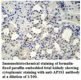 Anti-AP1S1 Antibody
