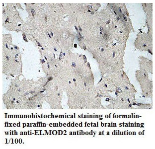 Anti-ELMOD2 Antibody