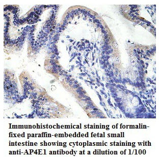 Anti-AP4E1 Antibody