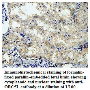 Anti-ORC5L Antibody