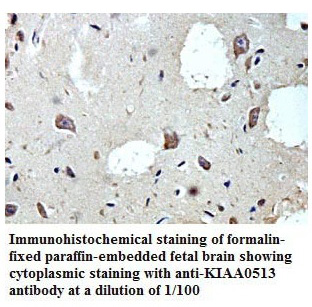 Anti-KIAA0513 Antibody