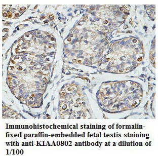 Anti-KIAA0802 Antibody