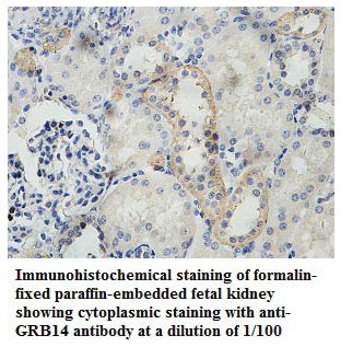 Anti-GRB14 Antibody