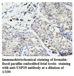 Anti-USP29 Antibody