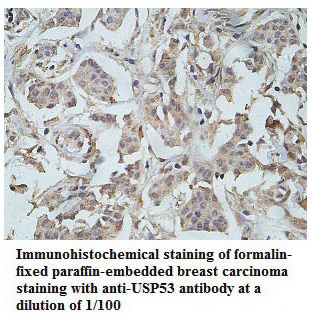 Anti-USP53 Antibody
