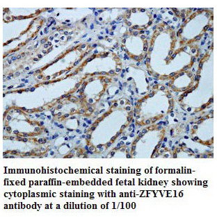 Anti-ZFYVE16 Antibody