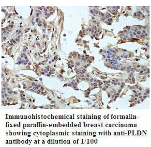Anti-PLDN Antibody