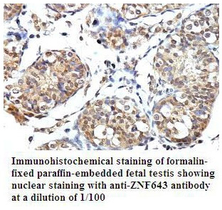 Anti-PLEKHJ1 Antibody