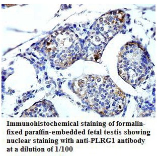 Anti-PLRG1 Antibody