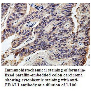 Anti-ERAL1 Antibody
