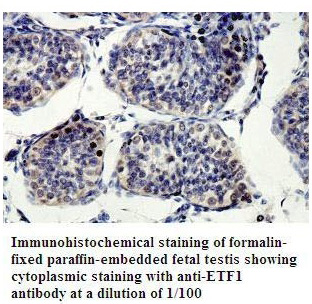 Anti-ETF1 Antibody