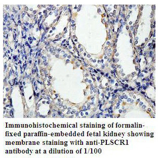 Anti-PLSCR1 Antibody