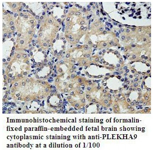 Anti-PLEKHA9 Antibody