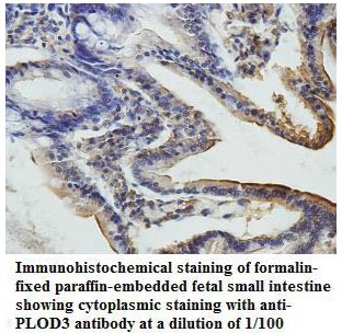 Anti-PLOD3 Antibody