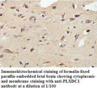 Anti-PLXDC1 Antibody