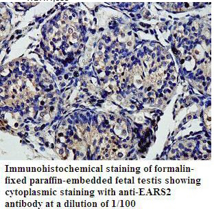 Anti-EARS2 Antibody