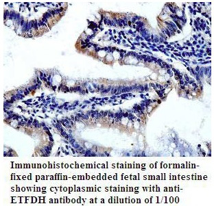 Anti-ETFDH Antibody