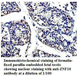 Anti-ZNF10 Antibody