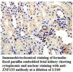 Anti-ZNF133 Antibody