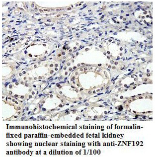 Anti-ZNF192 Antibody