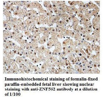 Anti-ZNF562 Antibody