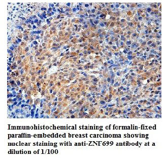 Anti-ZNF699 Antibody