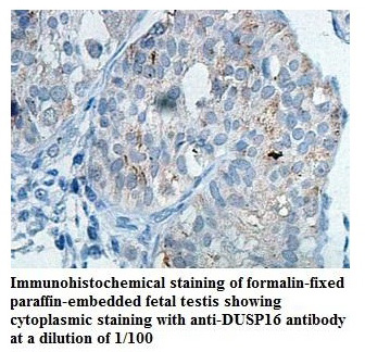 Anti-DUSP16 Antibody