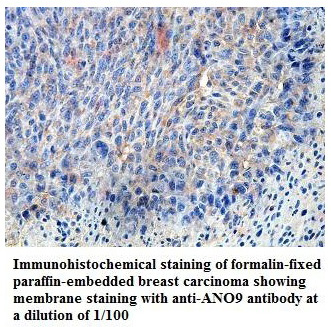 Anti-ANO9 Antibody