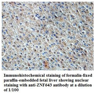 Anti-ZNF643 Antibody