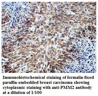 Anti-PMM2 Antibody