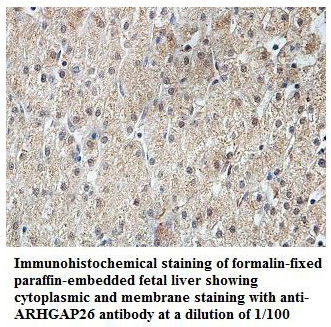 Anti-ARHGAP26 Antibody