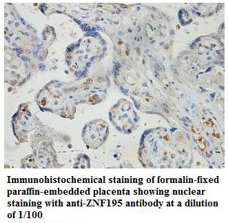 Anti-ZNF195 Antibody