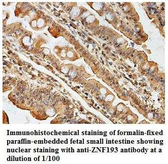 Anti-ZNF193 Antibody