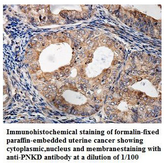 Anti-PNKD Antibody