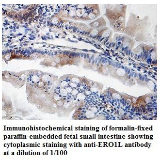 Anti-ERO1L Antibody