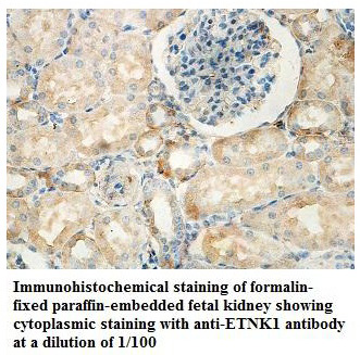 Anti-ETNK1 Antibody