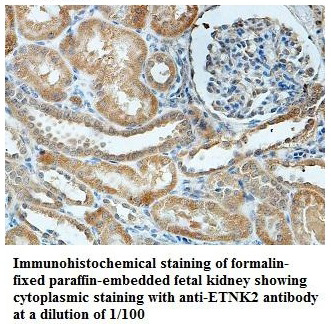 Anti-ETNK2 Antibody