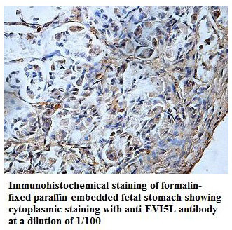 Anti-EVI5L Antibody