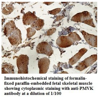 Anti-PMVK Antibody