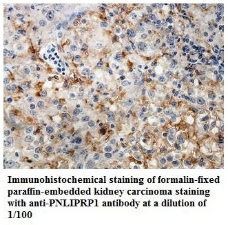 Anti-PNLIPRP1 Antibody