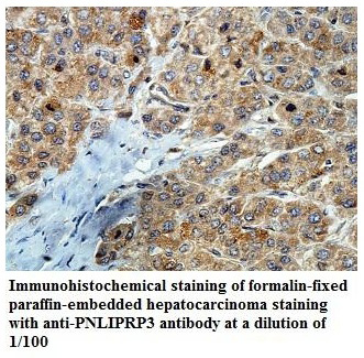 Anti-PNLIPRP3 Antibody