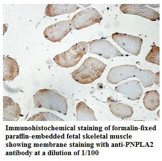 Anti-PNPLA2 Antibody